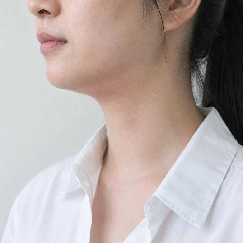 시술 직후